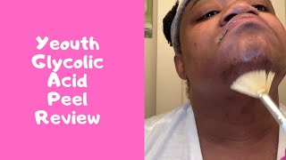 Yall its Product Review Time Yeouth Glycolic Acid Gel Peel [upl. by Jayson]