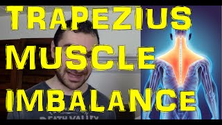 Muscle Imbalance Between Upper and Lower Trapezius Muscle Explained [upl. by Joliet240]