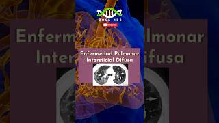 ENFERMEDAD PULMONAR INTERSTICIAL DIFUSA EN 1 Min salud medico doctor mrdoctor pulmones [upl. by Radford]