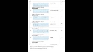 Relias Dysrhythmia Basic CH Identifying Dysrhythmias Exam Questions and Answers 2023 100 Verified [upl. by Heidy678]