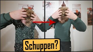 Schuppen loswerden  mehr als 10 Tipps  Trockene Kopfhaut [upl. by Deeraf271]