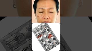 Limcee tablet to remove pigmentation dark spots acne scars dull skin viralshorts [upl. by Willabella]