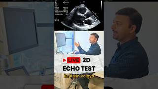 Live 2D Echo cardiography test heart echo live shorts shortsfeed short drkrishvaidya trend [upl. by Herwig660]