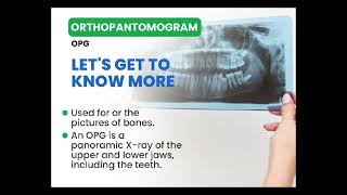 orthopantomogram OPG is a common radiograph used to identify the hard tissues of the oral cavity [upl. by Blaire]