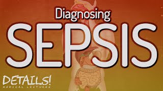 Diagnosing Sepsis  Details [upl. by Arretak]