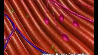 Mechanism of Botulinum Toxin [upl. by Nerti889]