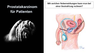 Prostatakarzinom für Patienten  Nebenwirkungen der Bestrahlung  Prof Hilke Vorwerk [upl. by Edelson788]