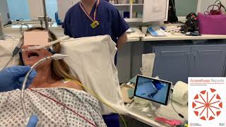 Awake tracheal intubation with the ProVu™️ video stylet a case series [upl. by Rodnas495]