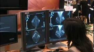 Hologic Unveils the Future of Breast Tomosynthesis [upl. by Aiselad]