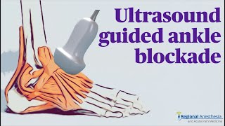 Ultrasound Guided Ankle Block [upl. by Aivad]