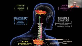 GSD2 Pompe  Dr Jonathan Rajan  Pompes Disease A Pain Medicine Perspective [upl. by Felix]