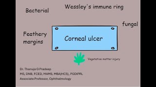 Corneal ulcer examination [upl. by Marb408]