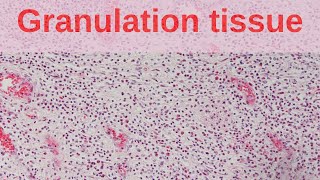 Stages of Wound Healing in 2 mins [upl. by Ducan]