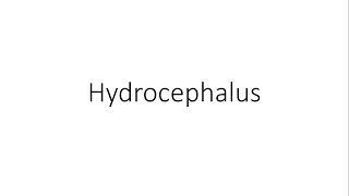 Hydrocephalus  General Surgery [upl. by Abroms654]