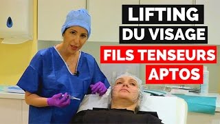 Fils tenseurs résorbables APTOS  Technique de pose [upl. by Atinram]