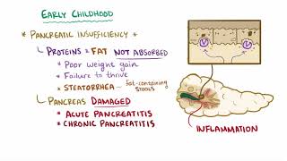 Cystic fibrosis causes symptoms diagnosis treatment amp pathology [upl. by Crystie]