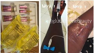 Glutathione Injection Whitening for black skin [upl. by Enneirdna]