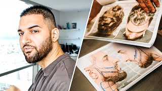 Meine Haartransplantation in der Türkei 🇹🇷 Ergebnisse nach 3 Jahren  Vorher amp Nachher [upl. by Hachmann]