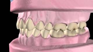 What is Orthodontics [upl. by Ikceb320]