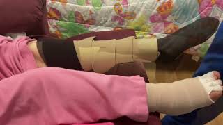 Effective Therapist Demonstration of Putting on Circaid Juxtalite Compression Garment for Caregivers [upl. by Erdman795]