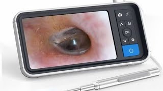 Otoscopio  endoscopio ótico WIFI RESEÑA Y UMBOXING ENDOSCOPE TOOL ANDROID [upl. by Thompson]