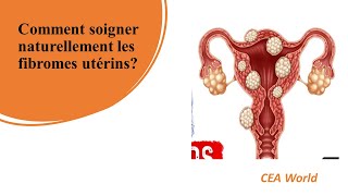 Comment soigner naturellement les fibromes utérins [upl. by Nileuqay812]