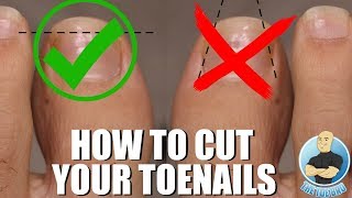 TRIMMING SUPER THICK AND LONG TOENAILS [upl. by Hau]