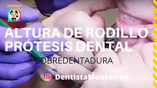 Cómo se Ajusta❓ RODILLO👅 SOBRE DENTADURA [upl. by Baelbeer841]