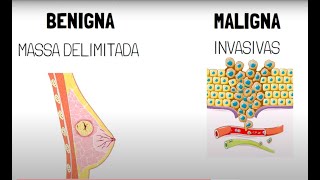 Neoplasia benigna x Neoplasia maligna [upl. by Orofselet]