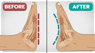 5 Exercises To Fix FlatFeet Fallen Arches [upl. by Eimor]