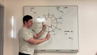 Two minute axis deviation made easy [upl. by Hallsy]