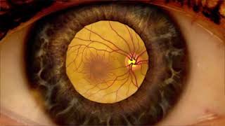 Patient Information  Dilated Eye Examination [upl. by Eirbua]