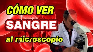 Cómo ver sangre al microscopio Qué se ve en nuestra Sangre al Microscopio [upl. by Litta80]