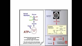 Cerebral Microdialysis [upl. by Ynogoham120]