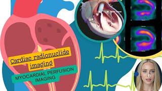 Cardiac radionuclideimaging [upl. by Olram82]