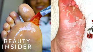 How A Chemical Peel Exfoliates Your Feet  Beauty Explorers [upl. by Afrika]