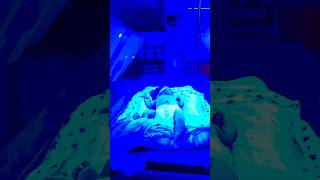 neonataljaundice hospital newborn doctor pediatrics phototherapyjaundicebaby phototherapy [upl. by Ahtnamas]