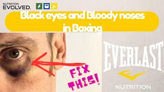 🚑Boxing Injury Management Black Eye amp Bloody Nose Treatment  Expert First Aid Tips🥊 [upl. by Gamali829]