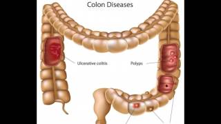 What is Bifidobacterium Infantis [upl. by Rickard137]