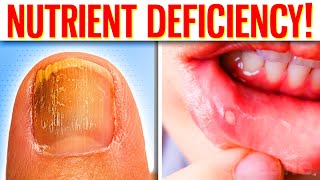 The 10 Hidden Signs Of Nutrient Deficiency You Should Never Ignore [upl. by Ynnob]