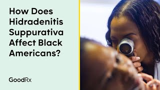 How Does Hidradenitis Suppurativa Affect Black Americans  GoodRx [upl. by Tildi259]