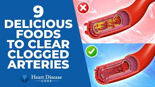 9 Delicious Foods To Clear Clogged Arteries [upl. by Sukramaj]