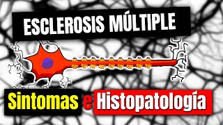 Esclerosis múltiple SINTOMAS E HISTOPATOLOGÍA  P2 [upl. by Corwin403]