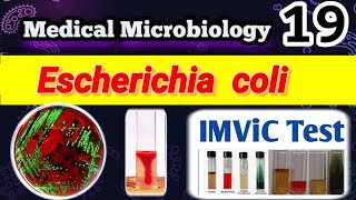 Escherichia coli part 2 شرح الشغل العملي بالعربي Identification and Laboratory diagnosis [upl. by Zildjian]