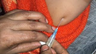 Im injection push  Intramural arms ceftriaxone Arixon 500 injection video 24 P31 by cannula 69 [upl. by Eniloj]