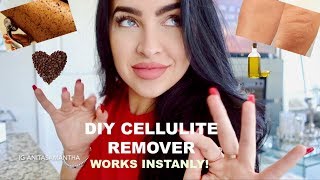 HOW TO REMOVE CELLULITE Naturally  Fast  DIY CELLULITE REMOVER 100 Works [upl. by Nickerson]