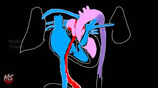 Fetal Circulation  Anatomy  Made easy  3 minutes [upl. by Vudimir900]