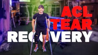 Can I Recover From a Full ACL TEAR  My ACL TEAR Recovery Protocol [upl. by Nnayr]