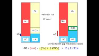 Metabolic Acidosis  Anion Gap  M Lam [upl. by Deth]