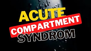 Compartment Syndrome Symptoms Diagnosis and Treatment [upl. by Halika]